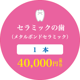 セラミックの歯（メタルボンドセラミック） 1本 40,000円（税込）